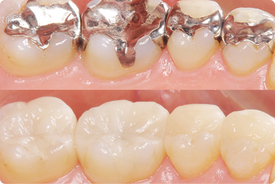 セレックのイメージ